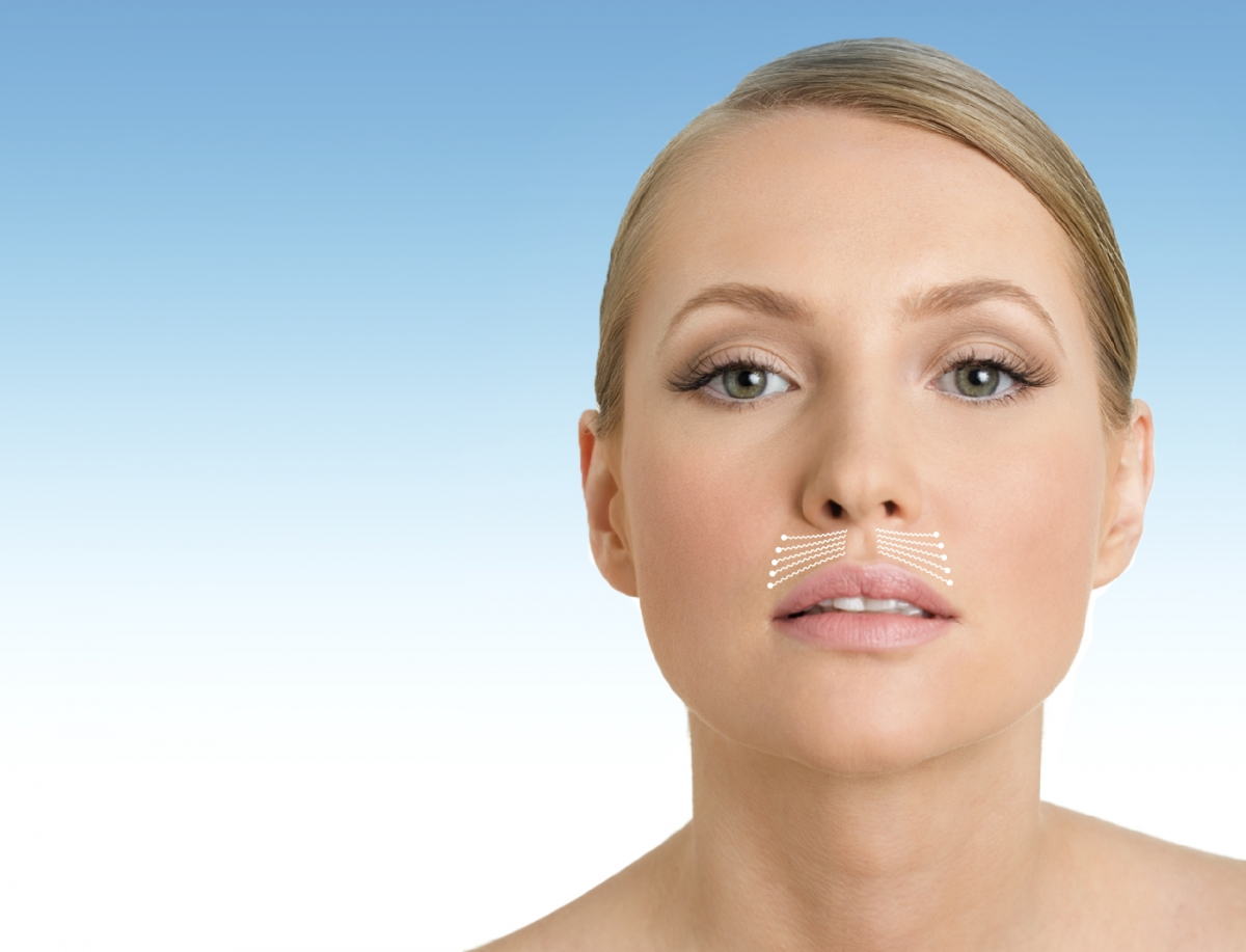 Mutes zona - augšējā lūpa