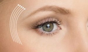 Область глаз "гусиные лапки"