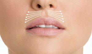 Lip boosting "purse strings"